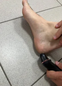 מכשיר פדיקור חשמלי מקצועי לשיוף והסרת עור יבש וקשה מכפות הרגליים photo review