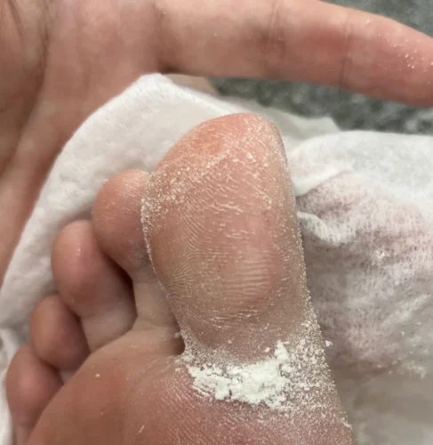 מכשיר פדיקור חשמלי מקצועי לשיוף והסרת עור יבש וקשה מכפות הרגליים photo review