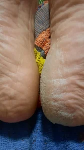 מכשיר פדיקור חשמלי מקצועי לשיוף והסרת עור יבש וקשה מכפות הרגליים photo review